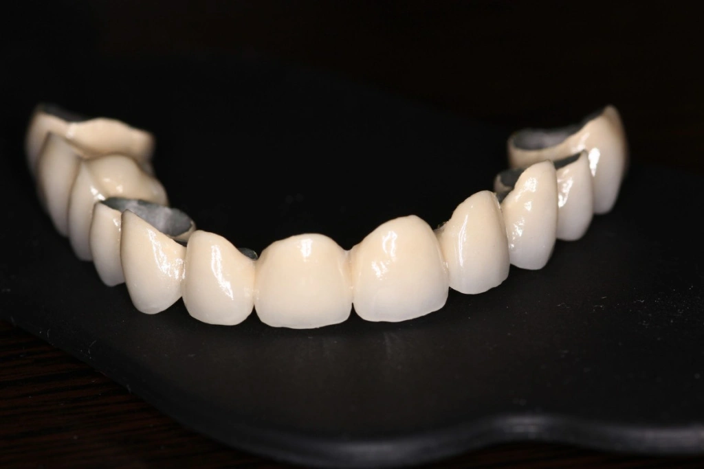 несъемные протезы.jpg несъемные протезы.jpg